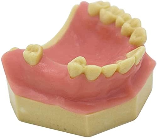 Стоматологичен Модел На Зъбите, Стоматологичен Демонстрационен Модел На Зъбите Премия Стоматологичен Стандартния Модел На Зъби За Възрастни, За Да Проверите За У?